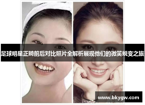 足球明星正畸前后对比照片全解析展现他们的微笑蜕变之旅
